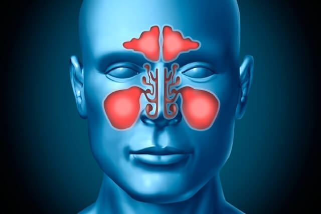 Are Sinus Infection Contagious